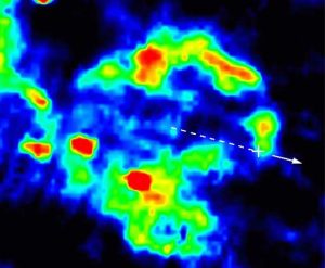 Infrared Image of Supernova Remnant; Dashed Line and Arrow Indicate Pulsar's Motion Detected by VLA.