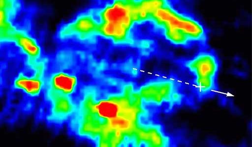 Infrared Image of Supernova Remnant; Dashed Line and Arrow Indicate Pulsar's Motion Detected by VLA.